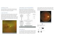 Retinal Ischemia and Concurrent Cerebral Infarction